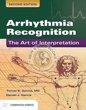 Arrhythmia Recognition 2E by Tomas B. Garcia 9781449642334