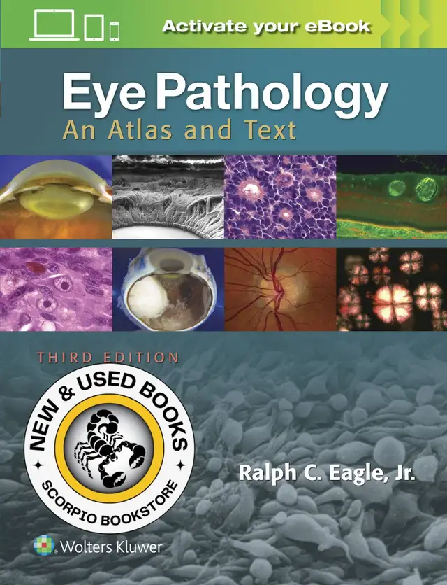 Eye Pathology 3rd Edition by Ralph C. Eagle Jr 9781496337177