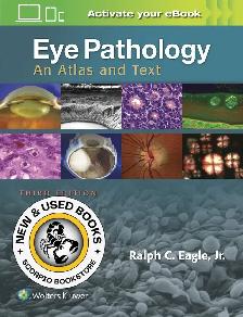 Eye Pathology 3rd Edition by Ralph C. Eagle Jr 9781496337177