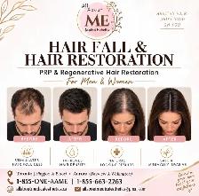 PRP Hair Fall Treatment