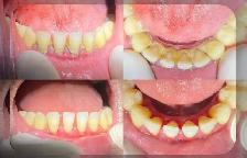 FREE CLEANING, X-RAYS & DENTIST CHECK - Photo 2