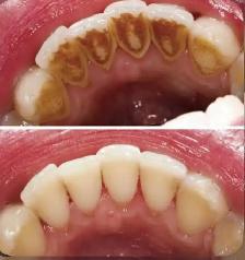FREE CLEANING, X-RAYS & DENTIST CHECK - Photo 3