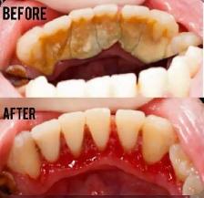 FREE CLEANING, X-RAYS & DENTIST CHECK - Photo 4