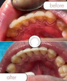 FREE CLEANING, X-RAYS & DENTIST CHECK - Photo 5