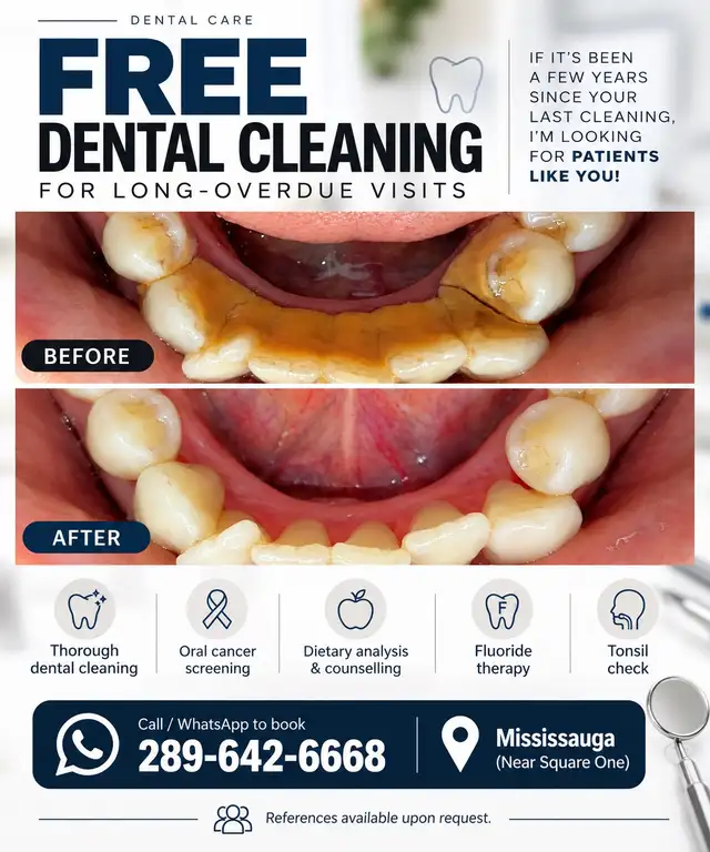 Free dental cleaning