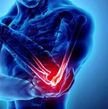 PRP joint Injections / Osteoarthritis treatment - Photo 2